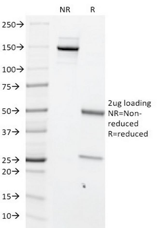 c-Myc Oncoprotein Antibody in SDS-PAGE (SDS-PAGE)