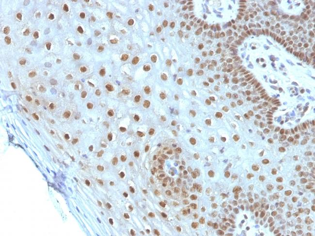 c-Myc Oncoprotein Antibody in Immunohistochemistry (Paraffin) (IHC (P))