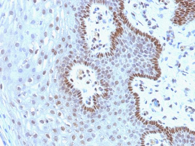 c-Myc Oncoprotein Antibody in Immunohistochemistry (Paraffin) (IHC (P))