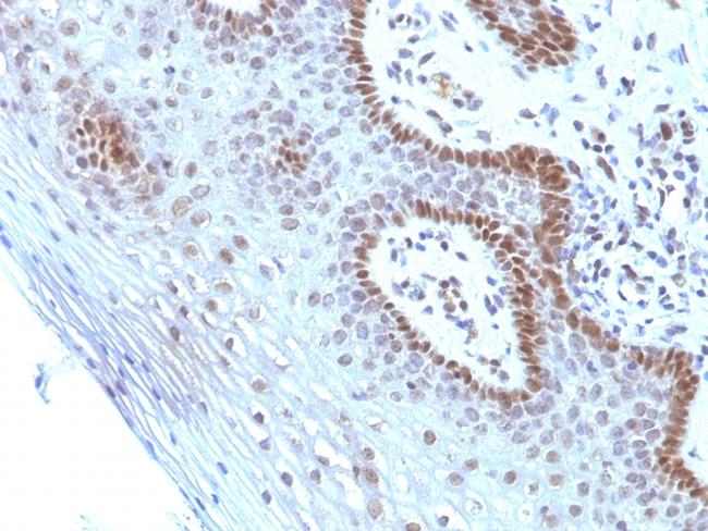 c-Myc Oncoprotein Antibody in Immunohistochemistry (Paraffin) (IHC (P))