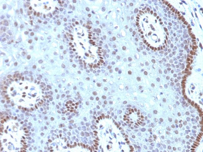 c-Myc Oncoprotein Antibody in Immunohistochemistry (Paraffin) (IHC (P))