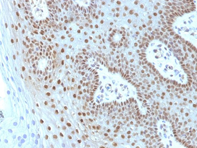 c-Myc Oncoprotein Antibody in Immunohistochemistry (Paraffin) (IHC (P))