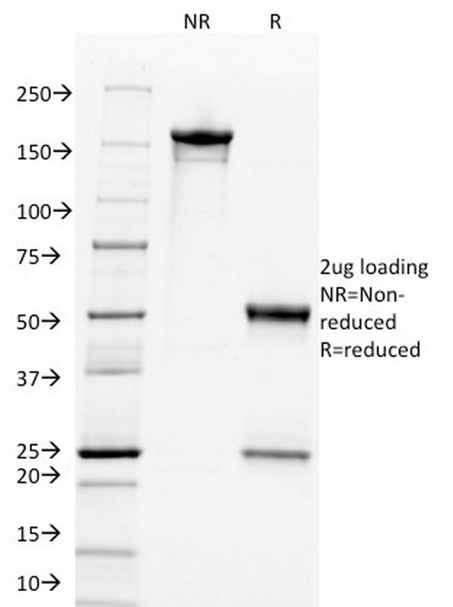 c-Myc Oncoprotein Antibody in SDS-PAGE (SDS-PAGE)