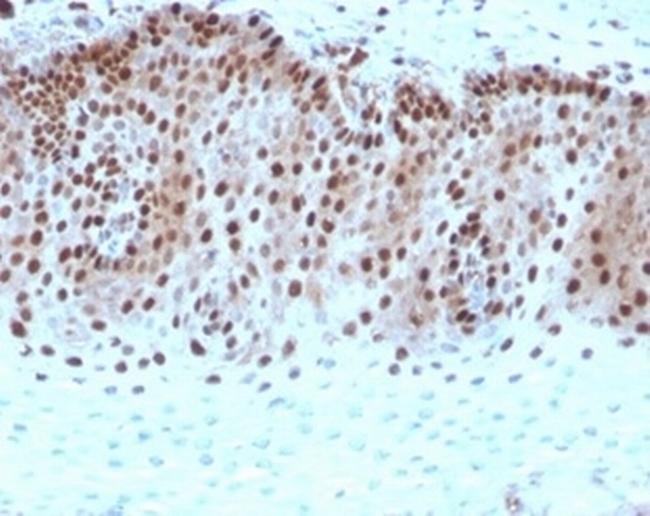 c-Myc Oncoprotein Antibody in Immunohistochemistry (Paraffin) (IHC (P))