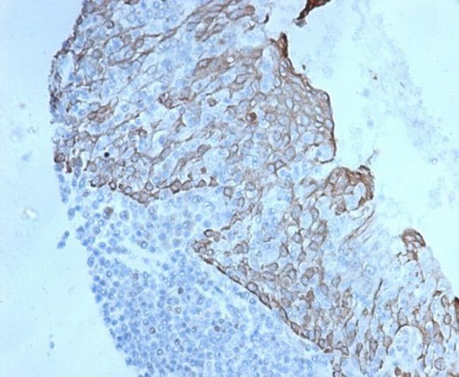 c-Myc Oncoprotein Antibody in Immunohistochemistry (Paraffin) (IHC (P))