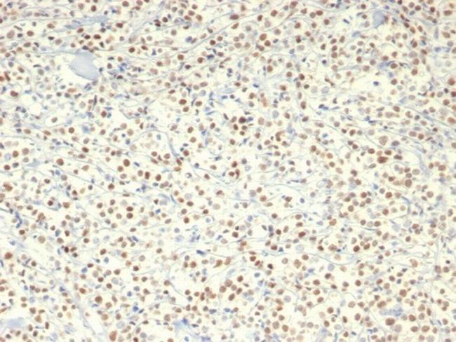 c-Myc Oncoprotein Antibody in Immunohistochemistry (Paraffin) (IHC (P))