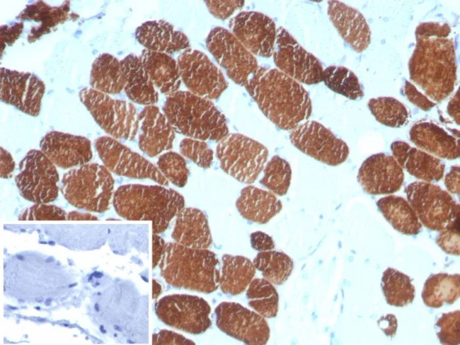 MYH7 Antibody in Immunohistochemistry (Paraffin) (IHC (P))