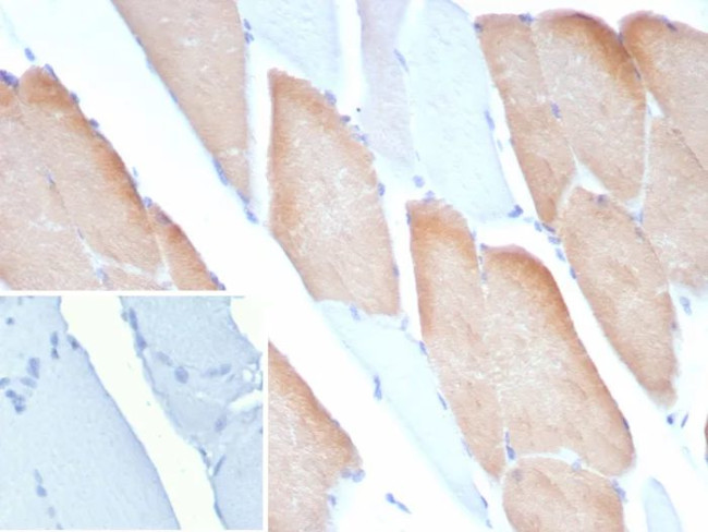 MYH7 Antibody in Immunohistochemistry (Paraffin) (IHC (P))