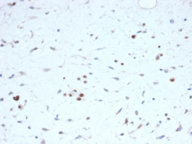 MyoD1 Antibody in Immunohistochemistry (Paraffin) (IHC (P))