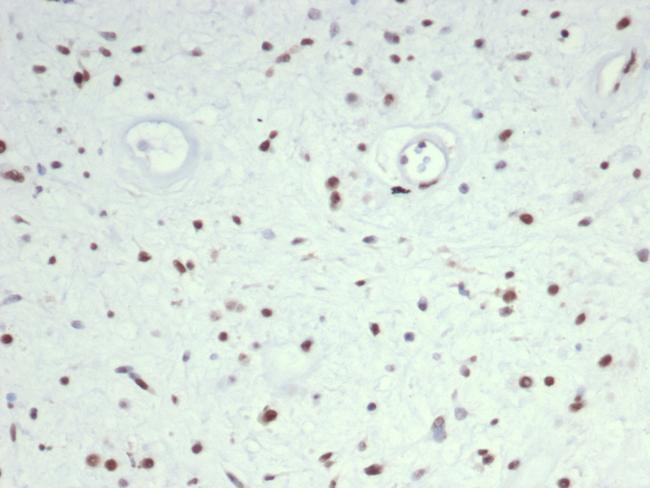 MyoD1 (Rhabdomyosarcoma Marker) Antibody in Immunohistochemistry (Paraffin) (IHC (P))