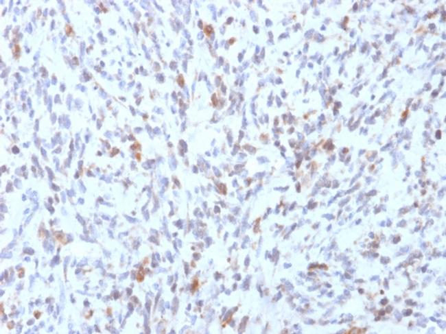 MyoD1 Antibody in Immunohistochemistry (Paraffin) (IHC (P))