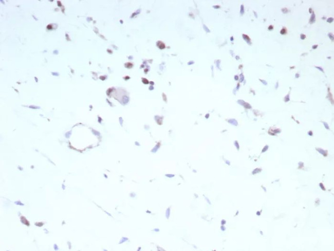 MyoD1 (Rhabdomyosarcoma Marker) Antibody in Immunohistochemistry (Paraffin) (IHC (P))