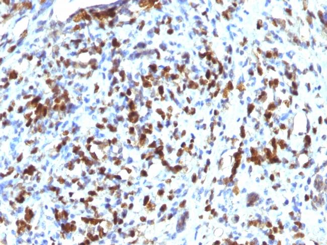 MyoD1 Antibody in Immunohistochemistry (Paraffin) (IHC (P))