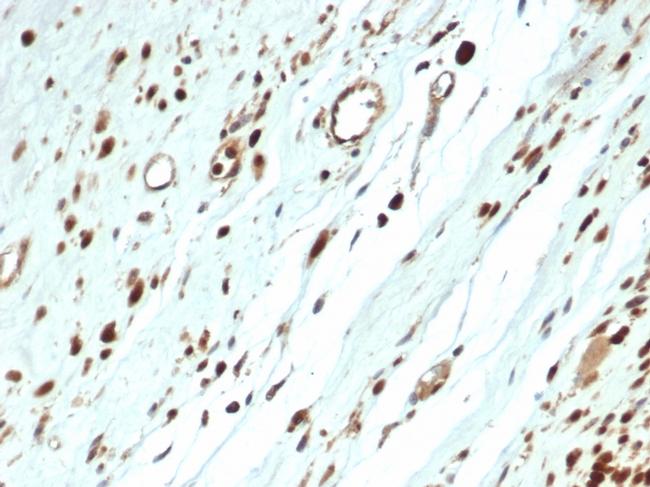 MyoD1 Antibody in Immunohistochemistry (Paraffin) (IHC (P))