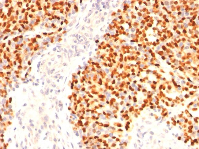 Myogenin/Myf-4 (Skeletal Muscle Marker) Antibody in Immunohistochemistry (Paraffin) (IHC (P))