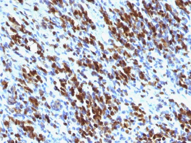 Myogenin/Myf-4 (Skeletal Muscle Marker) Antibody in Immunohistochemistry (Paraffin) (IHC (P))