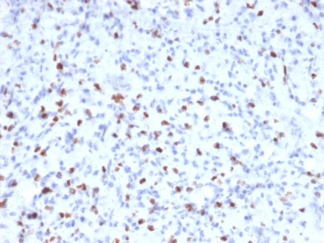 Myogenin/Myf-4 (Skeletal Muscle Marker) Antibody in Immunohistochemistry (Paraffin) (IHC (P))