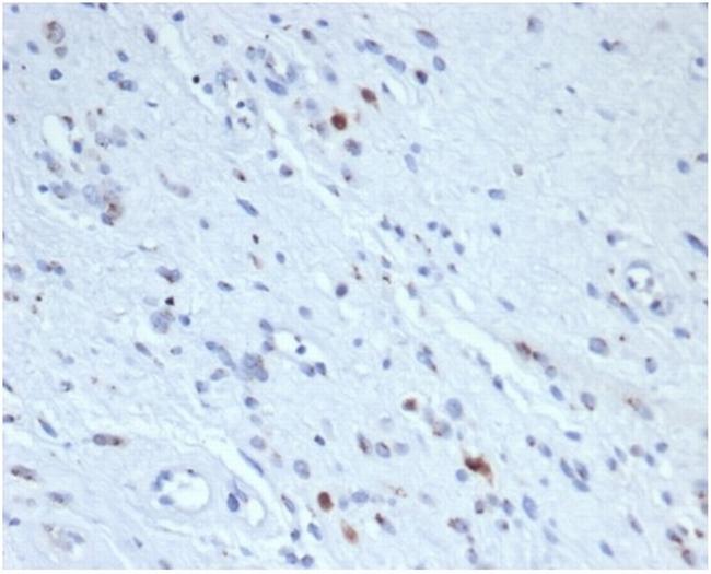 Myogenin/Myf-4 (Skeletal Muscle Marker) Antibody in Immunohistochemistry (Paraffin) (IHC (P))