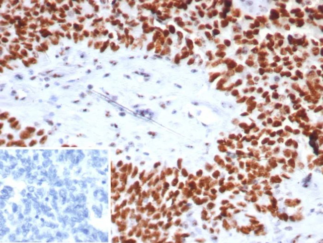 Nucleolin (Marker of Human Cells) Antibody in Immunohistochemistry (Paraffin) (IHC (P))