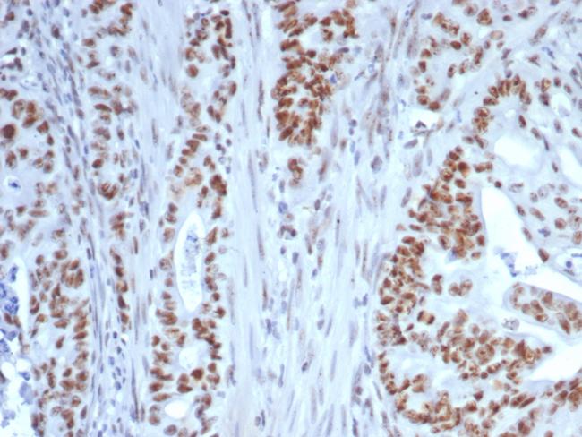 Nucleolin (Marker of Human Cells) Antibody in Immunohistochemistry (Paraffin) (IHC (P))