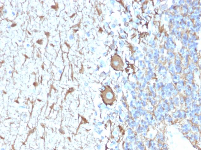 Neurofilament Antibody in Immunohistochemistry (Paraffin) (IHC (P))