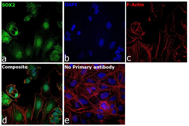 SOX2 Antibody in Immunocytochemistry (ICC/IF)