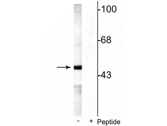 Phospho-MEK5 (Ser311, Thr315) Antibody in Western Blot (WB)