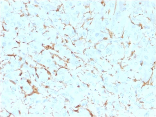 NGF-Receptor (p75)/CD271 (Soft Tissue Tumor Marker) Antibody in Immunohistochemistry (Paraffin) (IHC (P))