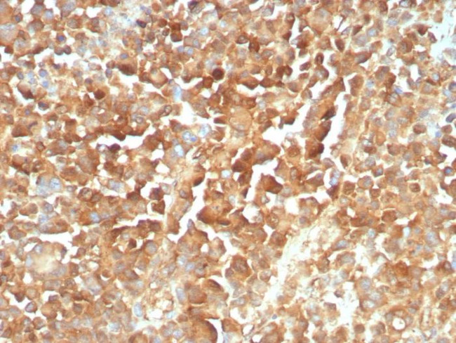 NGF-Receptor (p75)/CD271 (Soft Tissue Tumor Marker) Antibody in Immunohistochemistry (Paraffin) (IHC (P))