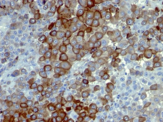 NGF-Receptor (p75)/CD271 (Soft Tissue Tumor Marker) Antibody in Immunohistochemistry (Paraffin) (IHC (P))