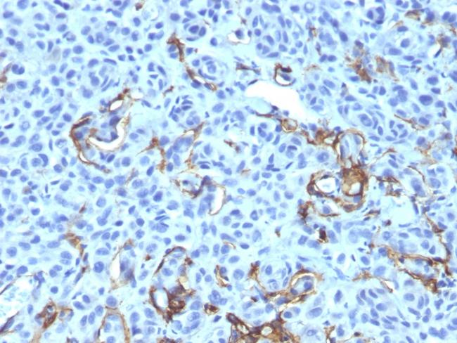 NGF-Receptor (p75)/CD271 (Soft Tissue Tumor Marker) Antibody in Immunohistochemistry (Paraffin) (IHC (P))