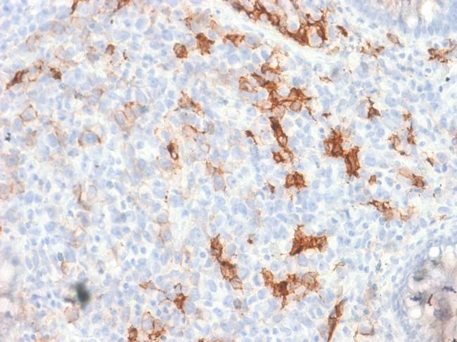 NGF-Receptor (p75)/CD271 Antibody in Immunohistochemistry (Paraffin) (IHC (P))