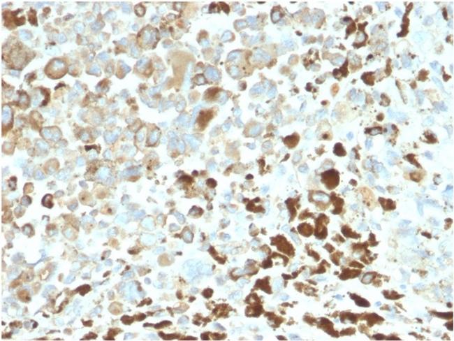 NGF-Receptor (p75)/CD271 Antibody in Immunohistochemistry (Paraffin) (IHC (P))