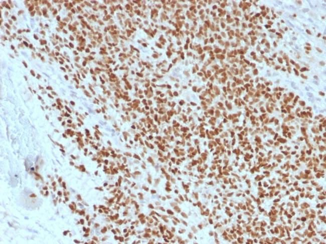 NKX2.2 Antibody in Immunohistochemistry (Paraffin) (IHC (P))