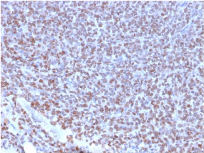 NKX2.2 Antibody in Immunohistochemistry (Paraffin) (IHC (P))