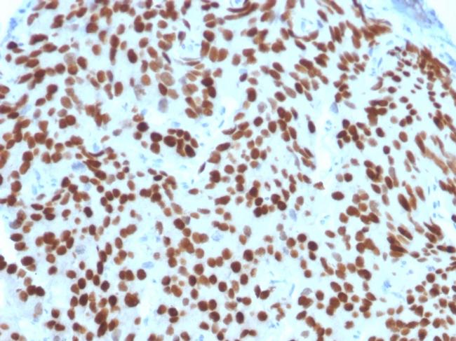 NKX3.1 Antibody in Immunohistochemistry (Paraffin) (IHC (P))