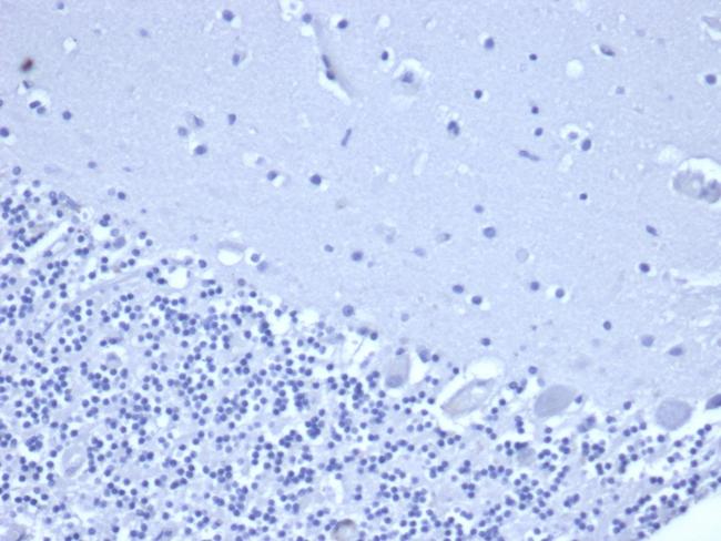 NKX3.1 (Metastatic Prostate Adenocarcinoma Marker) Antibody in Immunohistochemistry (Paraffin) (IHC (P))