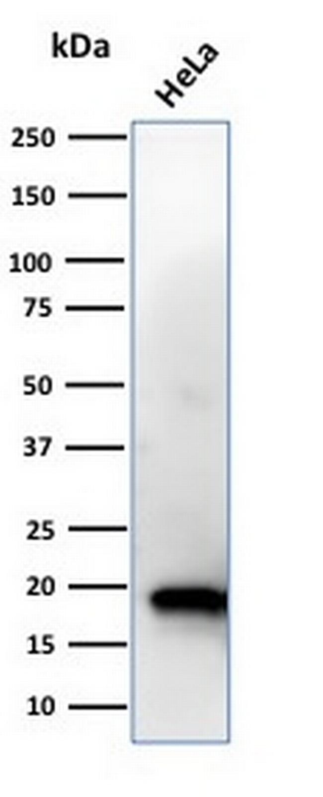 NME1/nm23-H1/NDPK-A (Suppressor of Metastasis) Antibody in Western Blot (WB)