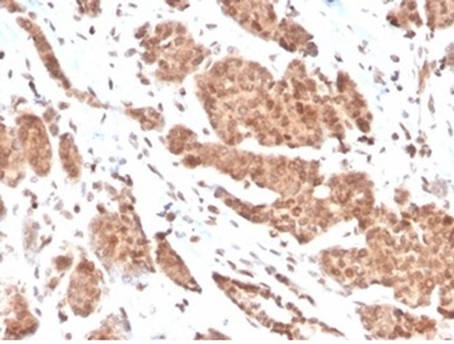 Nucleoside Diphosphate Kinase A/nm23-H1 Antibody in Immunohistochemistry (Paraffin) (IHC (P))