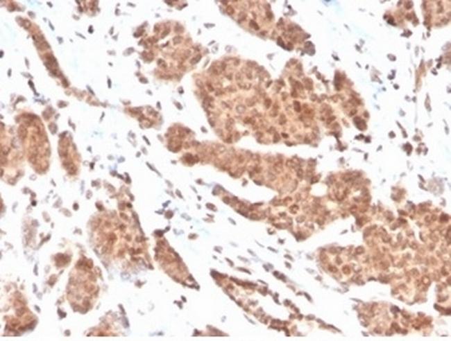 Nucleoside Diphosphate Kinase A/nm23-H1 Antibody in Immunohistochemistry (Paraffin) (IHC (P))