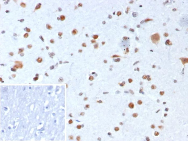 Nucleophosmin (Acute Myeloid Leukemia Marker) Antibody in Immunohistochemistry (Paraffin) (IHC (P))