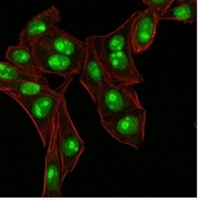 Nucleophosmin (Acute Myeloid Leukemia Marker) Antibody in Immunocytochemistry (ICC/IF)