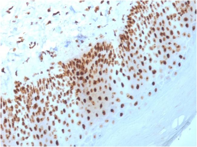 Nucleophosmin (Acute Myeloid Leukemia Marker) Antibody in Immunohistochemistry (Paraffin) (IHC (P))