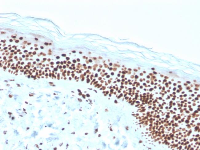 Nucleophosmin Antibody in Immunohistochemistry (Paraffin) (IHC (P))