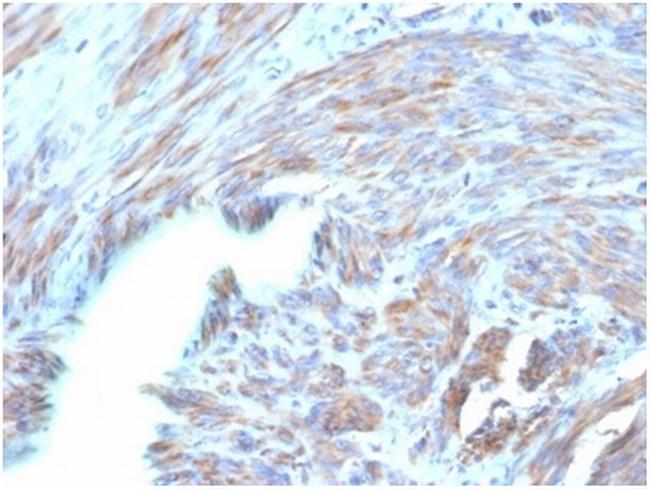 Natriuretic Peptide B/NPPB Antibody in Immunohistochemistry (Paraffin) (IHC (P))