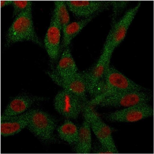 CD73 (Immuno-Oncology Target) Antibody in Immunocytochemistry (ICC/IF)