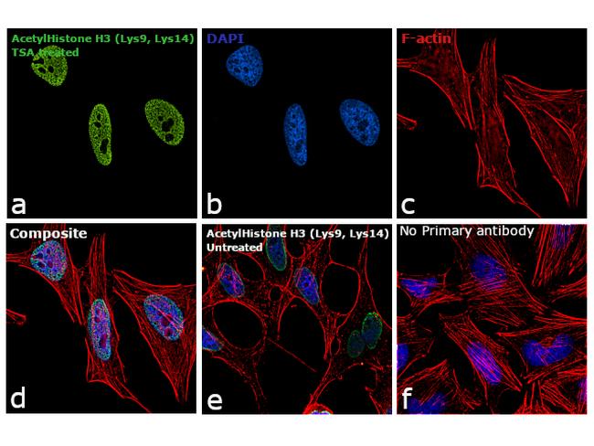 H3K9acK14ac Antibody in Immunocytochemistry (ICC/IF)