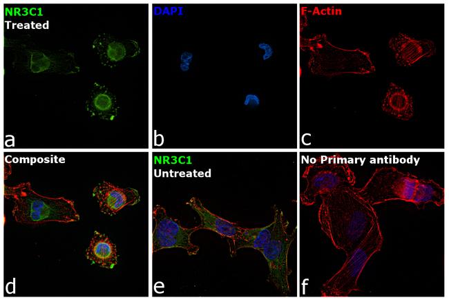 Glucocorticoid Receptor Antibody in Immunocytochemistry (ICC/IF)