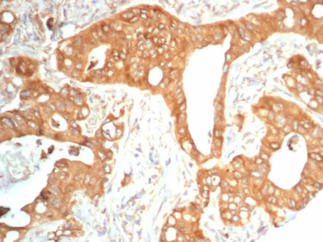 NTRK2 (Neurotrophic Receptor Tyrosine Kinase 2) Antibody in Immunohistochemistry (Paraffin) (IHC (P))