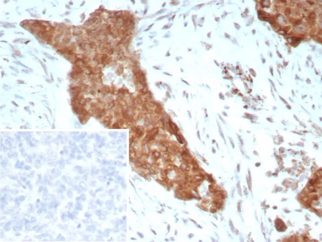 NTRK2 (Neurotrophic Receptor Tyrosine Kinase 2) Antibody in Immunohistochemistry (Paraffin) (IHC (P))